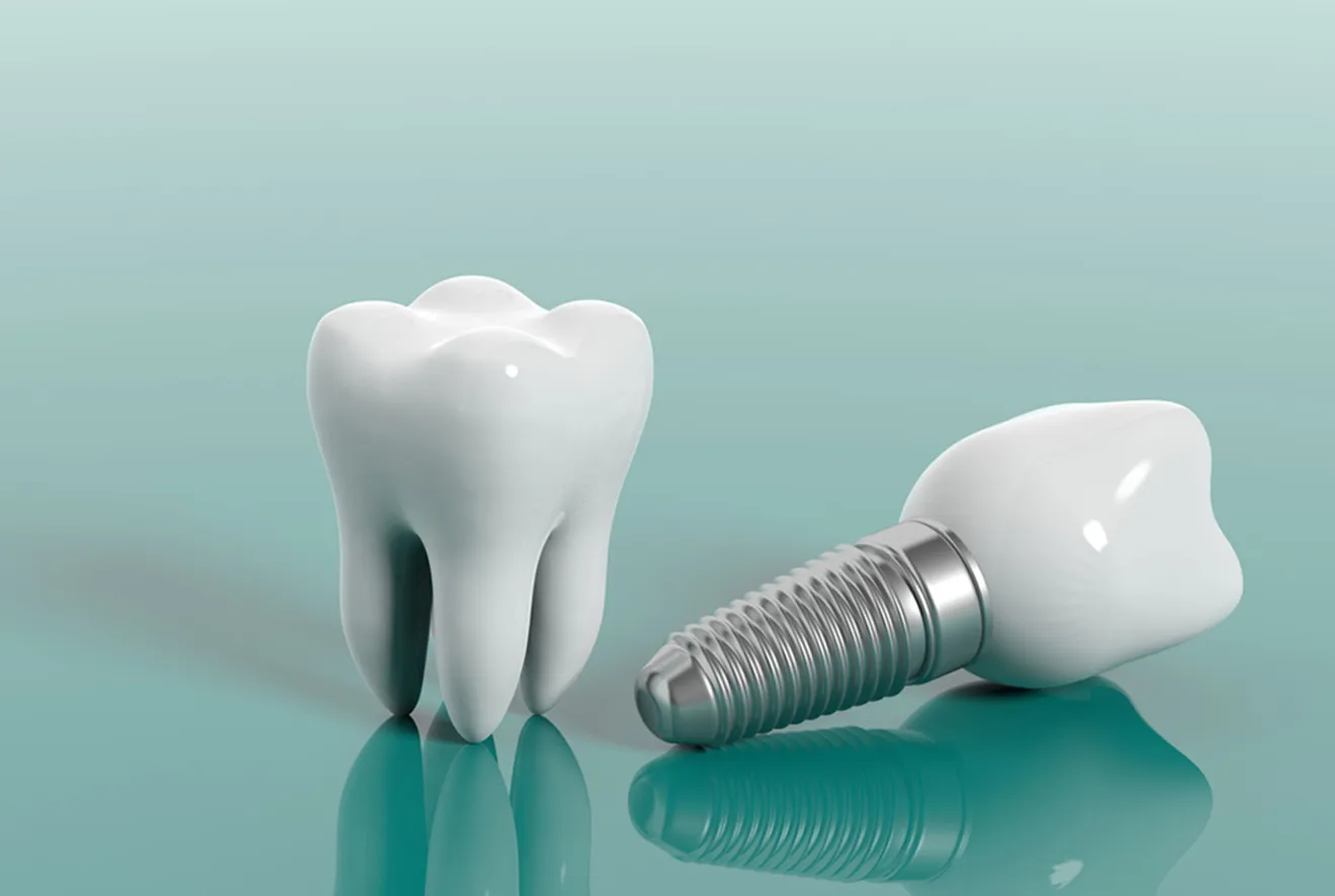 抜歯即時埋入法